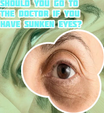 Dark circle eye treatment